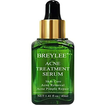 Acne Treatment Serum